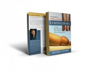 Book on Lymphedema and Lipedema written for the Patient