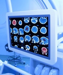 Medical Imaging Market - Research report, Industry Analysis, Growth Forecast 2023