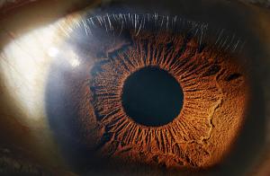 Ocular Hypertension Market Size Expected to Reach US$ 4,446.4 Million by 2033