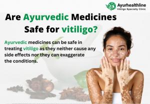 Ayurhealthline offers Holistic Treatment for Vitiligo