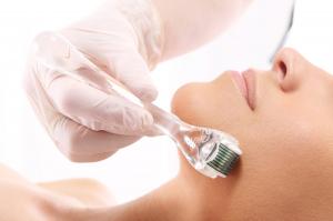 Microneedling Devices Market