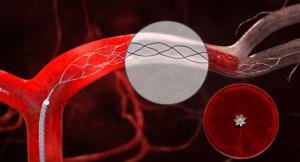 Clot Management Devices market