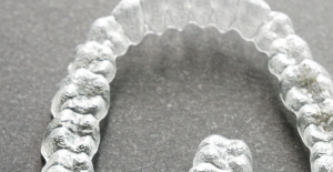 FirstClass Aligners Unveils New Reasons Why Clear Aligners Offer a Modern Alternative to Traditional Braces
