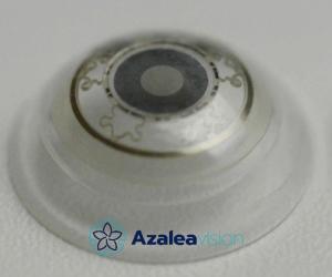 Azalea Vision smart lens
