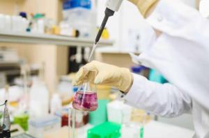 Sulfuric Acid Market