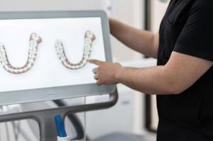 FirstClass Aligners Introduces Advanced Intraoral Scans for Local Patients