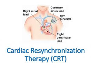 Cardiac Resynchronization Therapy Devices Market