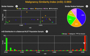 This is a graphic showing a visual representation of a malignancy score from RevealDx as integrated into contextflow ADVANCE Chest CT.