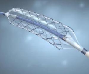 Nitinol SMAs