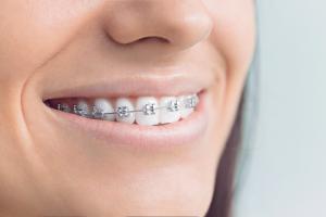 Orthodontics Market