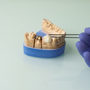 Latin America’s Dental Prosthetics Market Favors Ceramics and CAD/CAM Technology, Growing to Exceed B by 2030