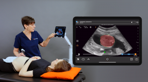 Sonographer scans a pregnant patient using OB AI with the Clarius wireless handheld ultrasound scanner.