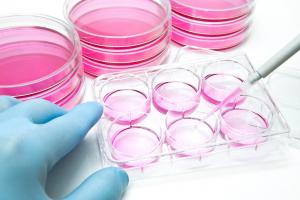 Cell Culture Market