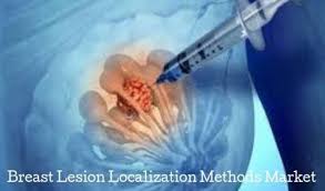 Breast Lesion Localization Methods Market