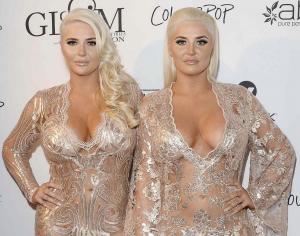 The Shannon Twins gold dresses