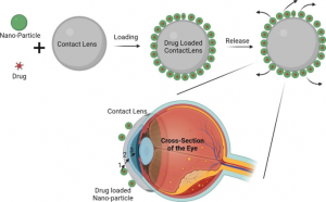 Contact_Lenses_Industry