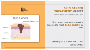 Skin Cancer Treatment Market Size, Share