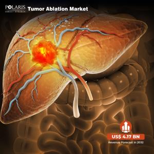 Tumor Ablation Market