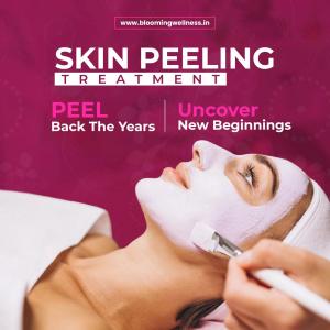 skin peeling