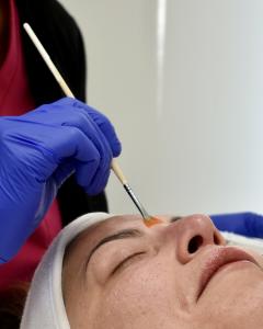  Chemical Peels