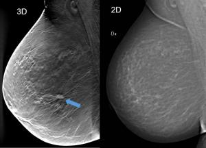 Breast Imaging Market Trade Analysis and Statistical Forecast (2024-2032)