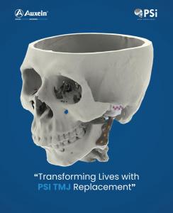 A customized Temporomandibular Joint (TMJ) implant by #Auxein #Orthopaedic