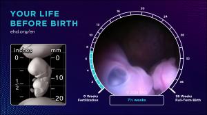 This image shows the right side of the face eye of a 7½-week human embryo with a close-up of the open right eye. The darkly pigmented retina is easily seen. The upper and lower eyelids are also visible. The right hand is touching the mouth region and an o