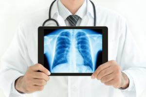 Hospital Mobile Xray market