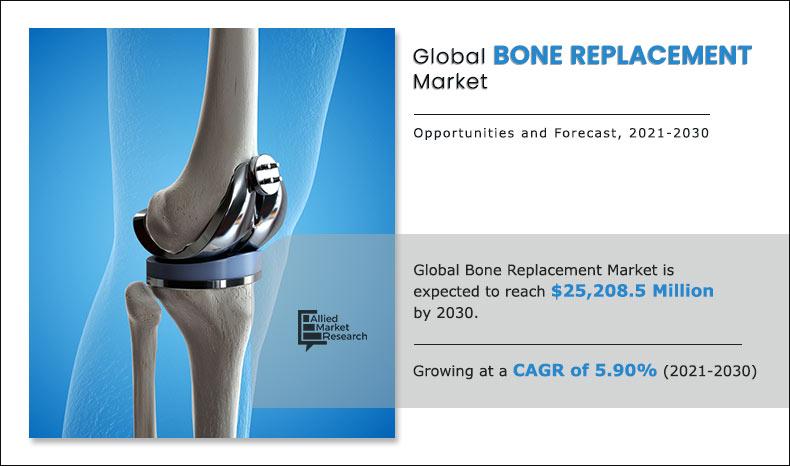 Bone Replacement Market Study Report