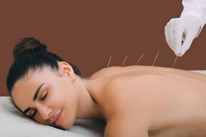 Acupuncturist