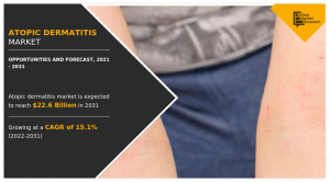 Atopic Dermatitis Market growth