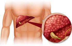 Gallbladder Cancer Market