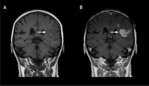 Contrast Media/Contrast Agent