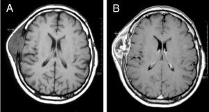 Contrast Agent