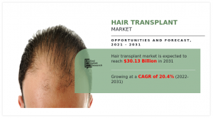 hair-transplant-market-A17033c