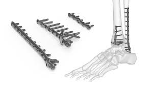 Orthopedic Devices