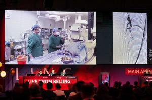 Full conference room of people watching a live case demonstration on a big screen