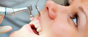  professional dental cleaning