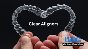 Clear Aligners Las Vegas