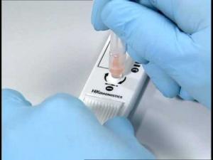 Influenza Diagnostics