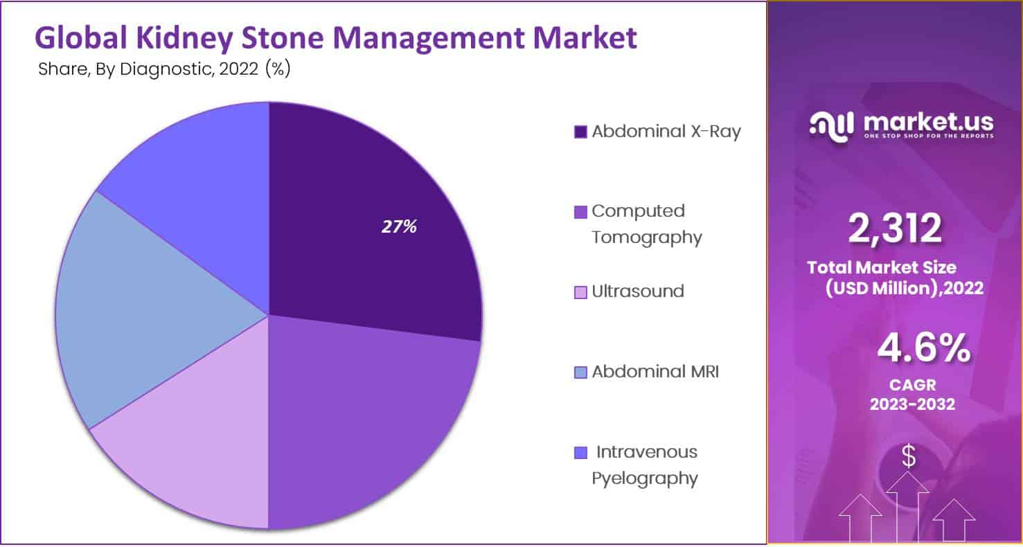 Kidney Stone Management Market Share Analysis