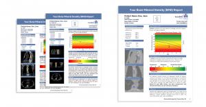 AutoBMD Patient Reports