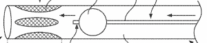 Image of an aspiration catheter with cushions at the distal end, designed to center within the vessel. The cushions are shown inverted.