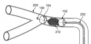 Illustration of Dual Expandable Elements, two uni-axial spheres mechanically expanding and contracting to capture clots.