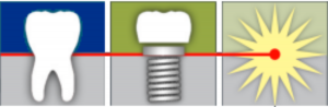 Logo displaying graphics of a tooth, an implant, and a laser starburst