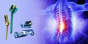 Global Spinal Implants Market