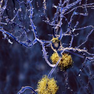 U.S. Transthyretin Amyloidosis Market 2025