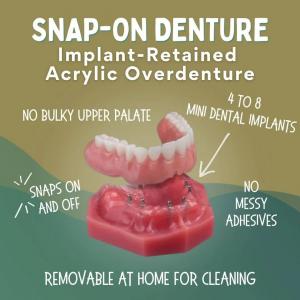 Snap-On Dentures in Emeryville, CA