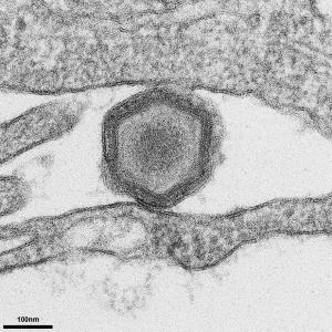 Electron micrograph of an African swine fever virus particle
