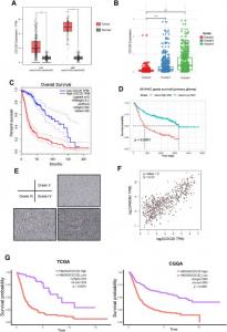 CDC20 was up-regulated in human glioma tissues and correlated with the prognosis of glioma patients.